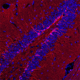 Doublecortin/DCX antibody in Mouse Brain by Immunohistochemistry (IHC-Fr).