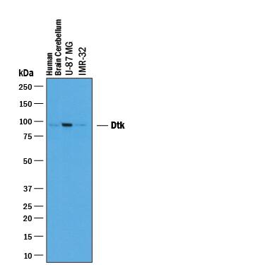 Detection of Human Tyro3/Dtk antibody by Western Blot.