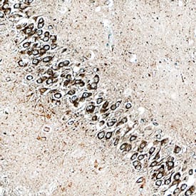 DCTN1 antibody in Human Brain by Immunohistochemistry (IHC-P).