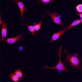 Dynactin Subunit 2/DCTN2 antibody in HeLa Human Cell Line by Immunocytochemistry (ICC).