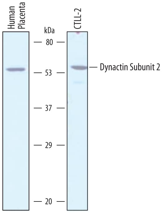 Detection of Human and Mouse Dynactin Subunit 2/DCTN2 antibody by Western Blot.