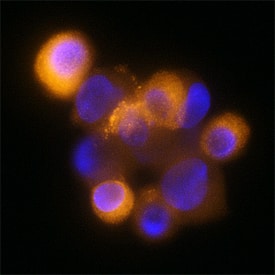 Dynactin Subunit 2/DCTN2 antibody in HeLa Human Cell Line by Immunocytochemistry (ICC).