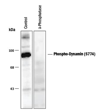 Detection of Phospho-Dynamin (S774) antibody by Western Blot.