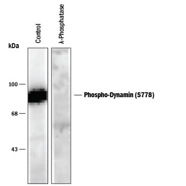 Detection of Phospho-Dynamin (S778) antibody by Western Blot.