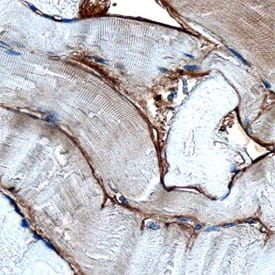 Dystroglycan antibody in Human Skeletal Muscle by Immunohistochemistry (IHC-P).