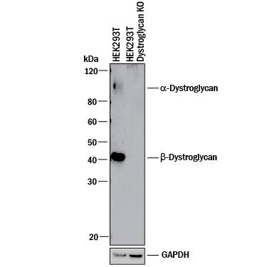 Western Blot Shows Human Dystroglycan Antibody Specificity by Using Knockout Cell Line.