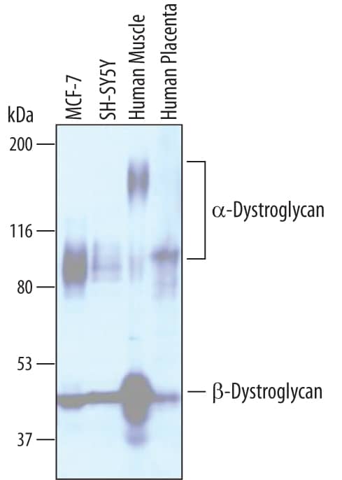 Detection of Human Dystroglycan antibody by Western Blot.