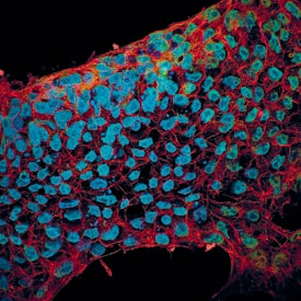 E-Cadherin and SOX2 in BG01V Human Stem Cells. E-Cadherin and SOX2 antibody in BG01V Human Stem Cells by Immunocytochemistry (ICC).