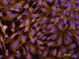 E-Selectin/CD62E antibody in HUVEC Cells by Immunocytochemistry (ICC).