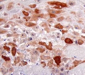 E2F-1 antibody in Human Placenta by Immunohistochemistry (IHC-P).