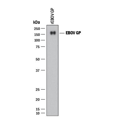 Detection of EBOV GP antibody by Western Blot.