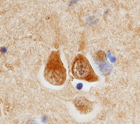 ECE-2 antibody in Human Brain by Immunohistochemistry (IHC-P).