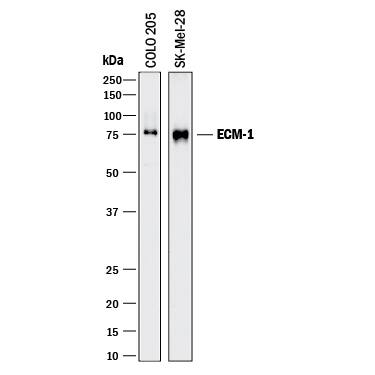 Detection of Human ECM-1 antibody by Western Blot.