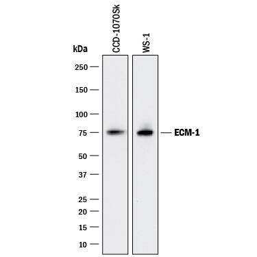 Detection of Human ECM-1 antibody by Western Blot.