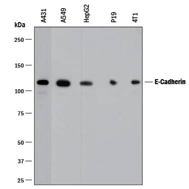 Detection of Human and Mouse E-Cadherin antibody by Western Blot.