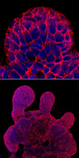 E-Cadherin antibody in Mouse Intestinal Organoids by Immunocytochemistry (ICC).