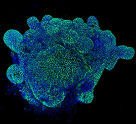 E-Cadherin antibody in Mouse Intestinal Organoids by Immunocytochemistry (ICC).
