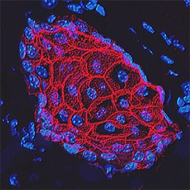E-Cadherin antibody in Mouse Skin by Immunohistochemistry (IHC-Fr).