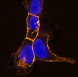 E-Cadherin antibody in A431 Human Cell Line by Immunocytochemistry (ICC).