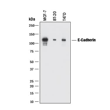 Detection of Human E-Cadherin antibody by Western Blot.