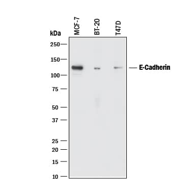 Detection of Human E-Cadherin antibody by Western Blot.