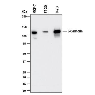 Detection of Human E-Cadherin antibody by Western Blot.