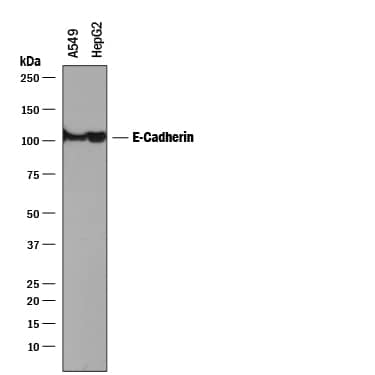 Detection of Human E-Cadherin antibody by Western Blot.