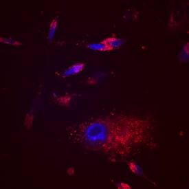 EDIL3 antibody in MDA-MB-231 Human Cell Line by Immunocytochemistry (ICC).