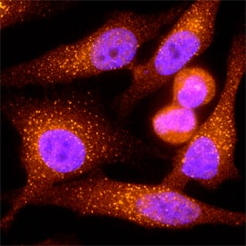 EEA1 antibody in HeLa Human Cell Line by Immunocytochemistry (ICC).