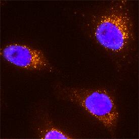 EEA1 antibody in HeLa Human Cell Line by Immunocytochemistry (ICC).