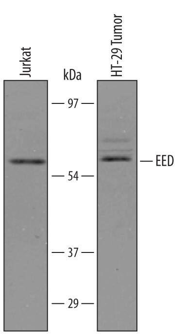 Detection of Human EED antibody by Western Blot.