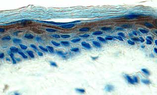EGF antibody in Human Skin by Immunohistochemistry (IHC-P).