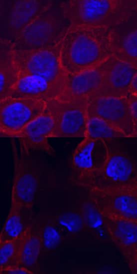 Phospho-EGFR (Y1173) antibody in A431 Human Cell Line by Immunocytochemistry (ICC).