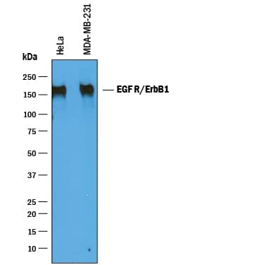 Detection of Human EGFR antibody by Western Blot.