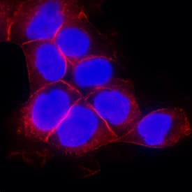 EGFR antibody in A431 Human Cell Line by Immunocytochemistry (ICC).