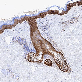 EGFR antibody in Human Skin by Immunohistochemistry (IHC-Fr).