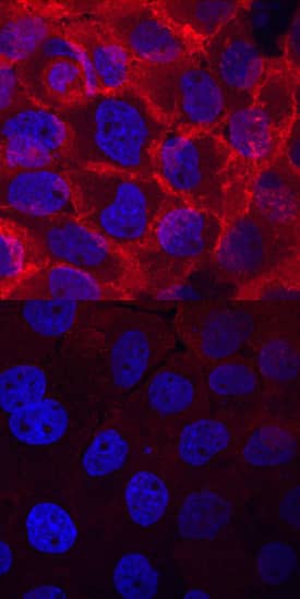 Phospho-EGFR (Y845) antibody in A431 Human Cell Line by Immunocytochemistry (ICC).