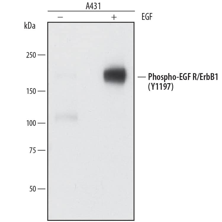 Detection of Human Phospho-EGFR (Y1197) antibody by Western Blot.