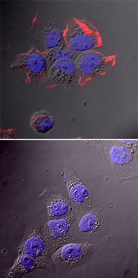 Phospho-EGFR (Y1197) antibody in A431 Human Cell Line by Immunocytochemistry (ICC).