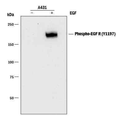 Detection of Human Phospho-EGFR (Y1197) antibody by Western Blot.