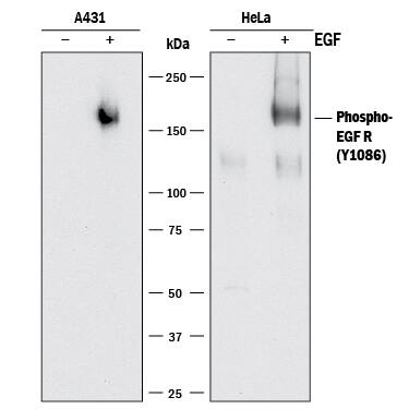 Detection of Human Phospho-EGFR (Y1086) antibody by Western Blot.