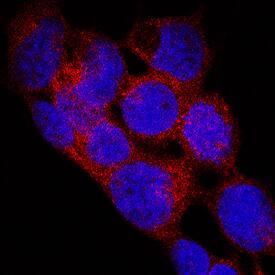 EGLN1/PHD2 antibody in WM-115 Human Cell Lines by Immunocytochemistry (ICC).