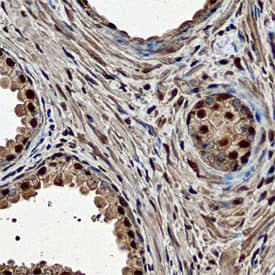 ELF3 antibody in Human Prostate by Immunohistochemistry (IHC-P).