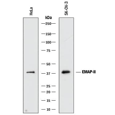 Detection of Human EMAP-II antibody by Western Blot.