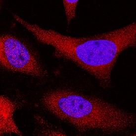 EMAP-II antibody in HeLa Human Cell Line by Immunocytochemistry (ICC).