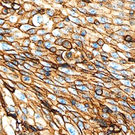 EMMPRIN/CD147 antibody in Human Cervix by Immunohistochemistry (IHC-P).