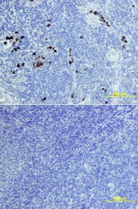EN-RAGE/S100A12 antibody in Human Tonsil by Immunohistochemistry (IHC-P).