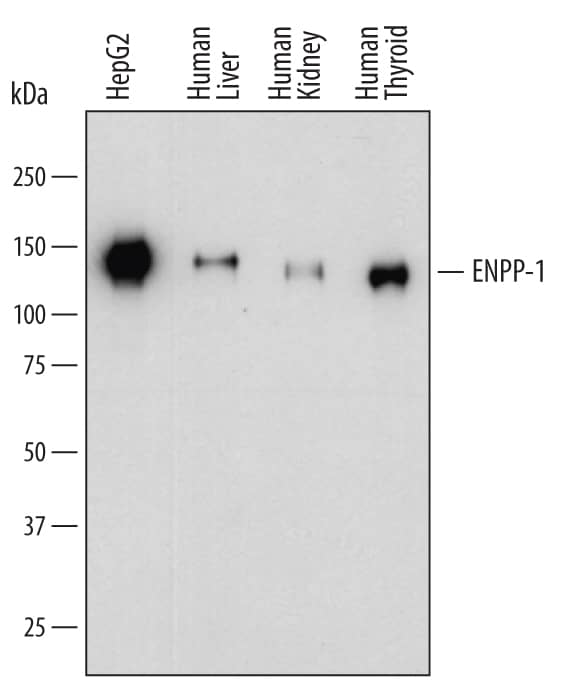 Detection of Human ENPP-1 antibody by Western Blot.