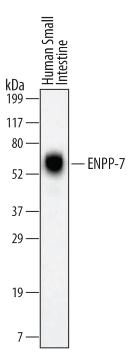 Detection of Human ENPP-7/Alk-SMase antibody by Western Blot.