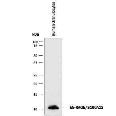 Detection of Human EN-RAGE/S100A12 antibody by Western Blot.